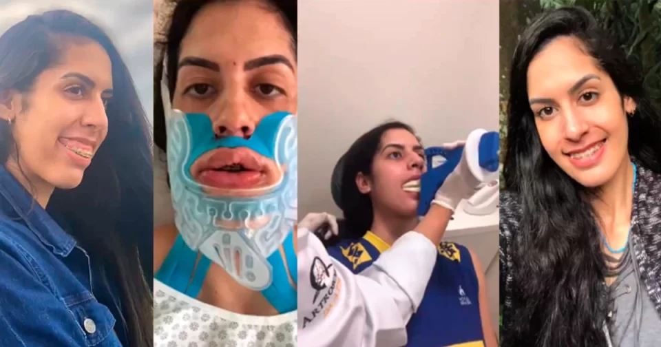 Central Diana de Barueri e da Seleção Brasileira em procedimento cirúrgico.