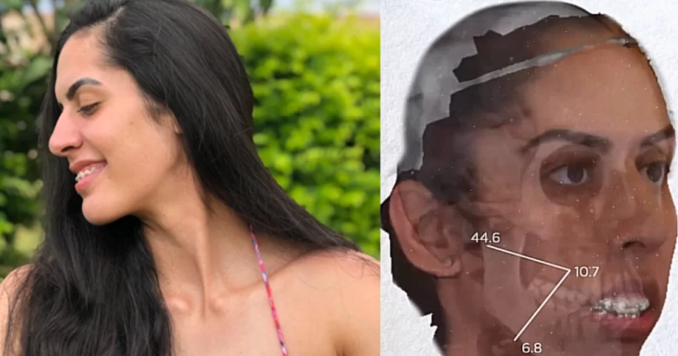 Central Diana de Barueri após cirurgia facial.